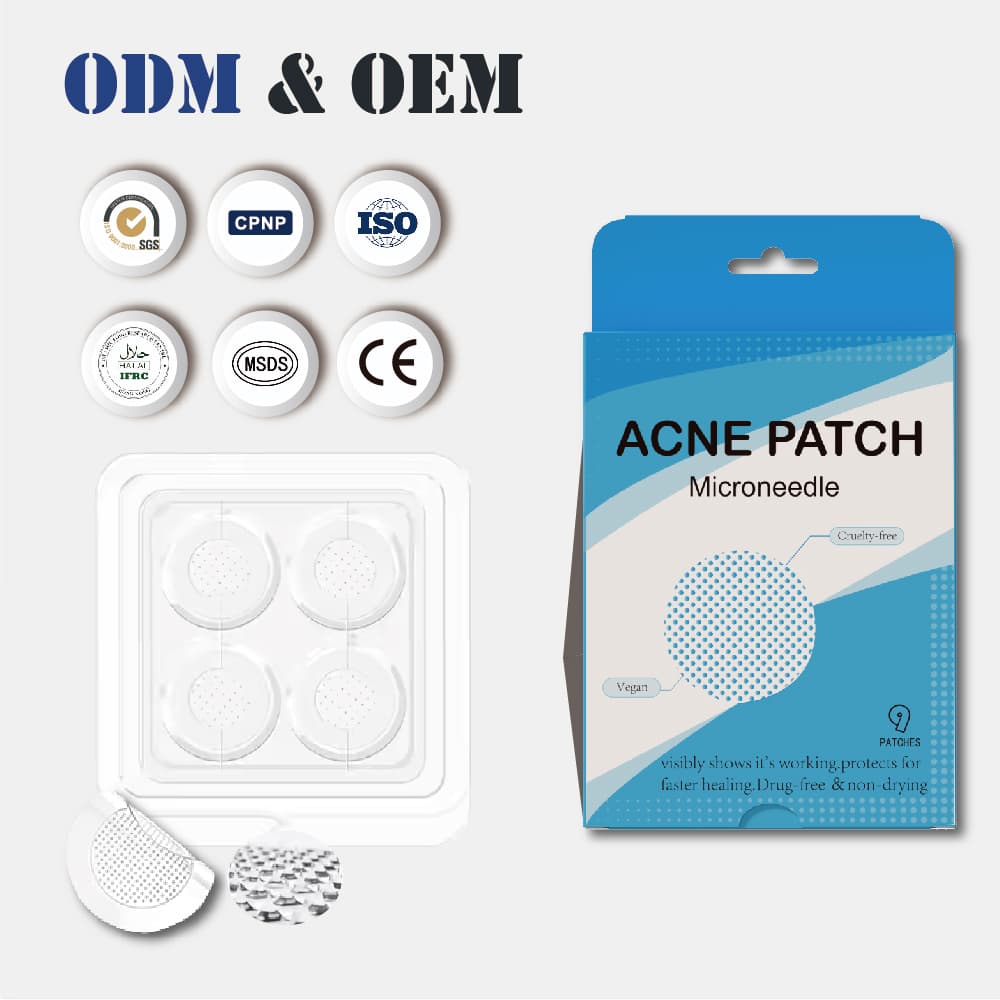 Customized Dissolving Microneedle Acne Patch Targeted Skin Care